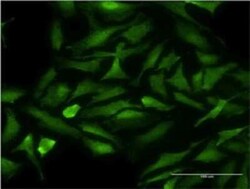 Novus Biologicals Cdk9 Antibody (2D7), Novus Biologicals 0.1 mg, Unconjugated:Antibodies,