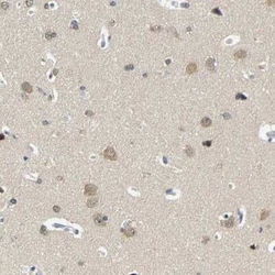 Centaurin alpha 1 Antibody, Novus Biologicals 0.1 mL | Buy Online | Novus Biologicals | Fisher Scientific