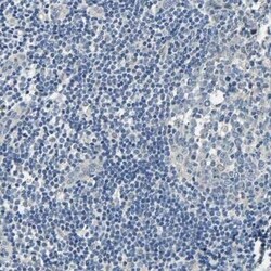 Centaurin alpha 1 Antibody, Novus Biologicals 0.1 mL | Buy Online | Novus Biologicals | Fisher Scientific