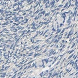 Centaurin alpha 1 Antibody, Novus Biologicals 0.1 mL | Buy Online | Novus Biologicals | Fisher Scientific
