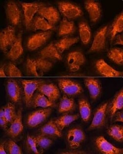 Centaurin beta 2 Antibody - Azide and BSA Free, Novus Biologicals:Antibodies:Primary