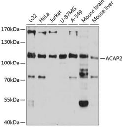 Centaurin beta 2 Antibody - Azide and BSA Free, Novus Biologicals:Antibodies:Primary