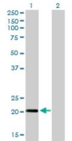 Centrin 3 Antibody (3E6), Novus Biologicals 50 &mu;g; Unconjugated:Antikörper