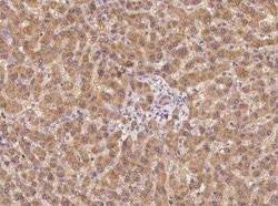 Ceruloplasmin Antibody, Novus Biologicals 100 &mu;g | Buy Online | Novus Biologicals | Fisher Scientific