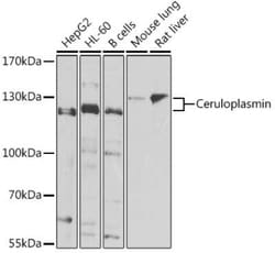 Ceruloplasmin Antibody - Azide and BSA Free, Novus Biologicals 0.02 mL,