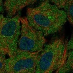 ChGn Rabbit anti-Human, Polyclonal, Novus Biologicals 25 &mu;g; Unconjugated:Antibodies,