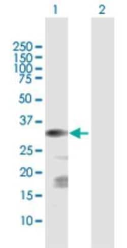 ChGn Antibody, Novus Biologicals 0.1 mg; Unconjugated:Antibodies, Polyclonal