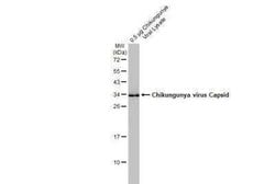 Chikungunya Virus Capsid Antibody, Novus Biologicals 100 &mu;g | Buy Online | Bio-Techne | Fisher Scientific