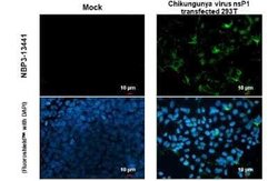 Chikungunya Virus nsp1 Antibody, Novus Biologicals 100 &mu;g | Buy Online | Novus Biologicals | Fisher Scientific
