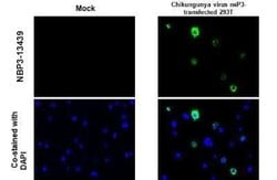 Chikungunya Virus nsp3 Antibody, Novus Biologicals 100 &mu;g; Unconjugated:Antikörper