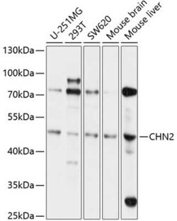 Chimaerin 2 Antibody - Azide and BSA Free, Novus Biologicals 0.1 mL, Unconjugated:Antibodies,