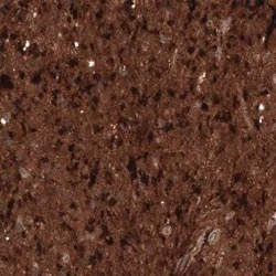 Chitinase 3-like 1 Mouse anti-Human, Clone: CL12241, Novus Biologicals