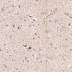 Chitinase 3-like 1 Mouse anti-Human, Clone: CL12241, Novus Biologicals