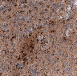 Chitinase 3-like 1 Mouse anti-Human, Clone: CL12241, Novus Biologicals