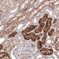 Chitinase 3-like 1 Mouse anti-Human, Clone: CL12241, Novus Biologicals