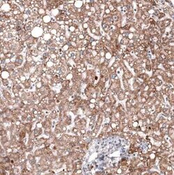Chitinase 3-like 1 Mouse anti-Human, Clone: CL12241, Novus Biologicals