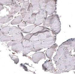 Chitinase 3-like 1 Mouse anti-Human, Clone: CL12241, Novus Biologicals