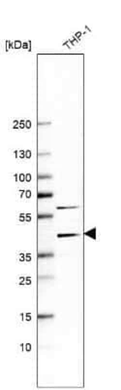 Chitinase 3-like 1 Mouse anti-Human, Clone: CL12241, Novus Biologicals