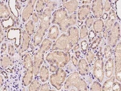 Chitinase 3-like 2 Antibody, Novus Biologicals 50 &mu;g, Unconjugated:Antibodies,