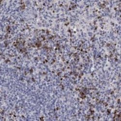 Chitotriosidase/CHIT1 Rabbit anti-Human, Polyclonal, Novus Biologicals:Antibodies:Primary