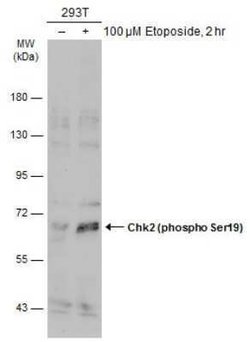 Chk2, p Ser19 Antibody, Novus Biologicals 100 &mu;g | Buy Online | Novus Biologicals | Fisher Scientific