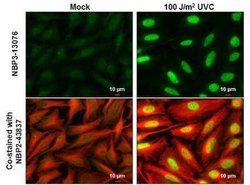 Chk2, p Thr68 Antibody, Novus Biologicals 100 &mu;g | Buy Online | Novus Biologicals | Fisher Scientific