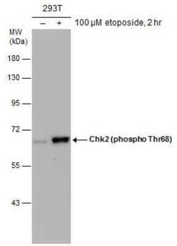 Chk2, p Thr68 Antibody, Novus Biologicals 100 &mu;g | Buy Online | Novus Biologicals | Fisher Scientific