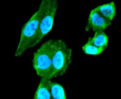 CholineAcetyltransferase/ChAT Rabbit anti-Human, Clone: JA67-11, Novus