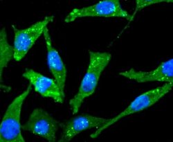 CholineAcetyltransferase/ChAT Rabbit anti-Human, Clone: JA67-11, Novus