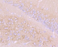 CholineAcetyltransferase/ChAT Rabbit anti-Human, Clone: JA67-11, Novus