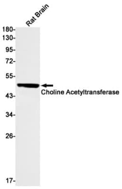 Choline Acetyltransferase/ChAT Antibody (S07-1G8), Novus Biologicals 100