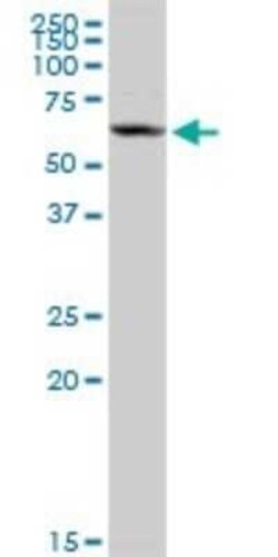 Choline dehydrogenase Antibody, Novus Biologicals 0.1 mg | Buy Online | Novus Biologicals | Fisher Scientific