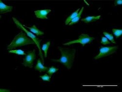 Choline kinase alpha Antibody, Novus Biologicals 0.1 mg | Buy Online | Novus Biologicals | Fisher Scientific
