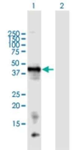 Novus Biologicals Chondromodulin-1/LECT1 Antibody, Novus Biologicals 0.05 mg | Buy Online | Novus Biologicals&trade; | Fisher Scientific
