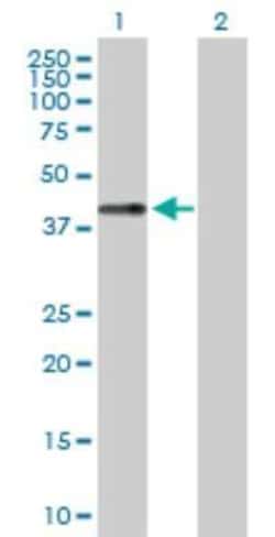 Chondromodulin-1/LECT1 Antibody, Novus Biologicals 0.1 mg, Unconjugated:Antibodies,