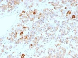 Chorionic Gonadotropin alpha Chain (hCG alpha) Antibody (LHa/756), Novus Biologicals 100 &mu;g | Buy Online | Novus Biologicals | Fisher Scientific