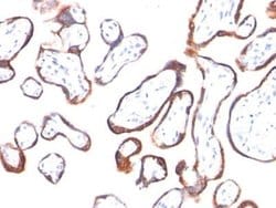 Chorionic Gonadotropin beta Chain (hCG beta) Antibody (HCGb/54), Novus