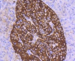 Chromogranin A Rabbit anti-Human, Rat, Clone: JM103-7, Novus Biologicals