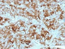 Chromogranin A Antibody (CGA/413 + CHGA/777 + CHGA/798), Novus Biologicals:Antibodies:Primary