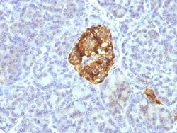 Chromogranin A Antibody (CGA/413 + CHGA/777 + CHGA/798), Novus Biologicals:Antibodies:Primary