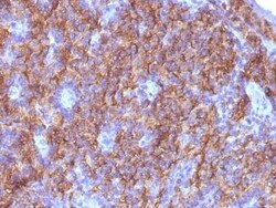 Chromogranin A Antibody (CGA/413 + CHGA/777 + CHGA/798), Novus Biologicals:Antibodies:Primary
