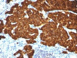 Chromogranin A Antibody (CGA/413 + CHGA/777 + CHGA/798), Novus Biologicals:Antibodies:Primary