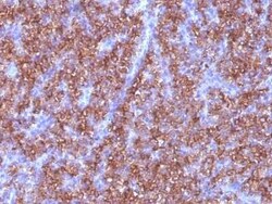 Chromogranin A Antibody (CGA/413), Novus Biologicals:Antibodies:Primary