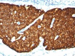 Chromogranin A Antibody (CGA/413), Novus Biologicals:Antibodies:Primary