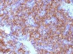 Chromogranin A Antibody (CHGA/798), Novus Biologicals:Antibodies:Primary