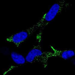 Chromogranin A Antibody (CL0166), Novus Biologicals 25 &mu;L, Unconjugated:Antikörper