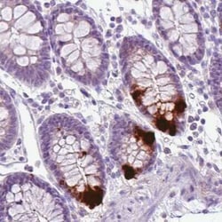 Chromogranin A Antibody (CL0166), Novus Biologicals 25 &mu;L, Unconjugated:Antikörper