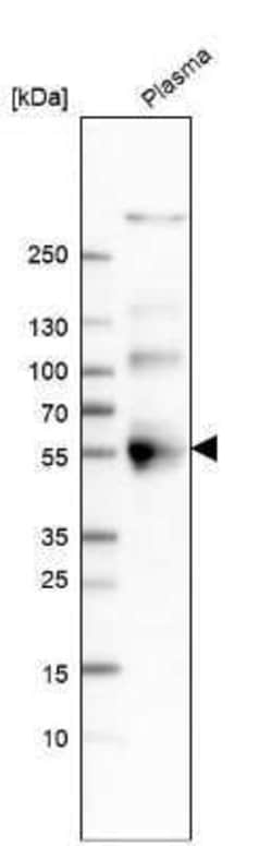 Chromogranin A Antibody, Novus Biologicals:Antibodies:Primary Antibodies