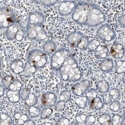 Chromogranin B Mouse anti-Human, Clone: CL11404, Novus Biologicals 25 &mu;g | Buy Online | Novus Biologicals | Fisher Scientific