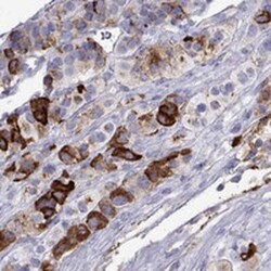 Chromogranin C Antibody, Novus Biologicals 25ul; Unconjugated:Antibodies,
